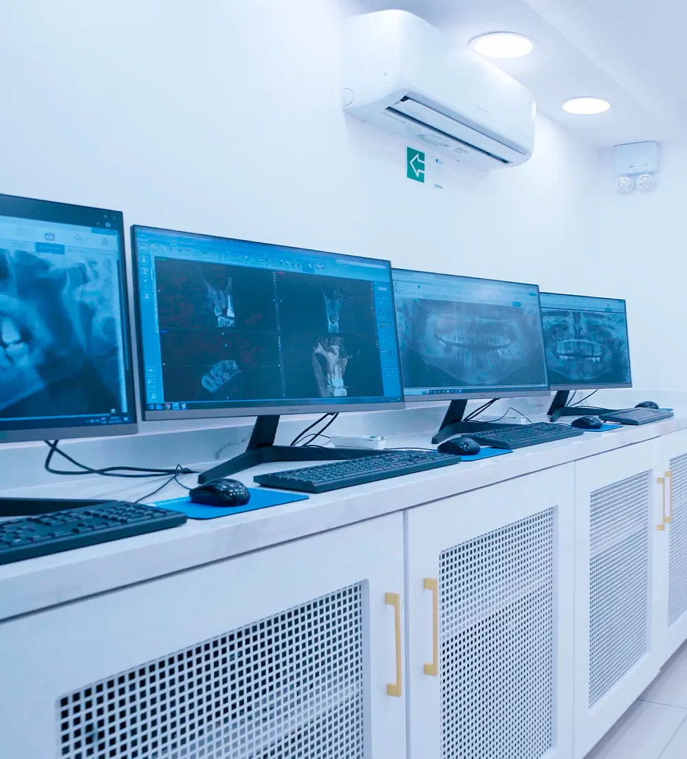 Consultorio dental moderno con monitores mostrando radiografías digitales