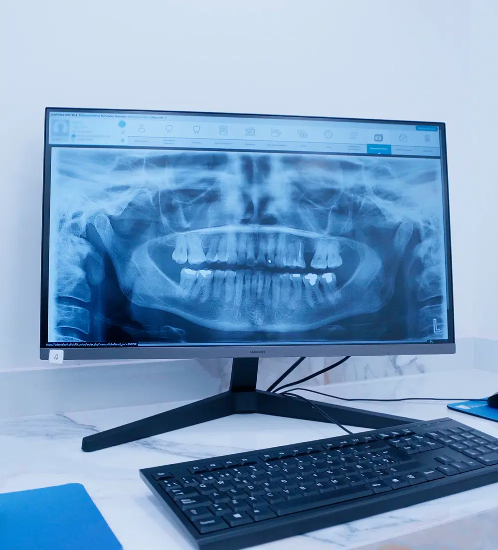 Monitor mostrando radiografía dental digital panorámica detallada