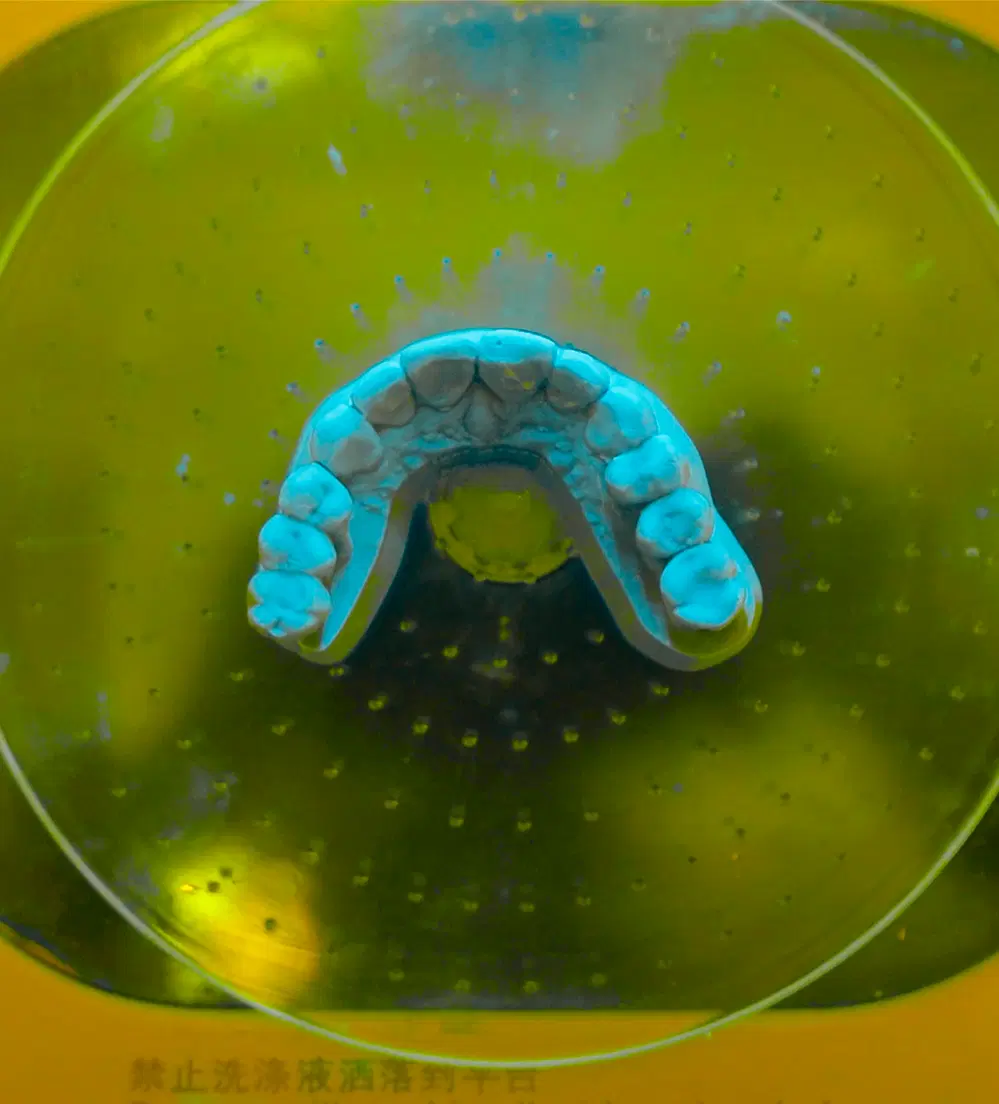 Consultorio dental moderno con monitores mostrando radiografías digitales