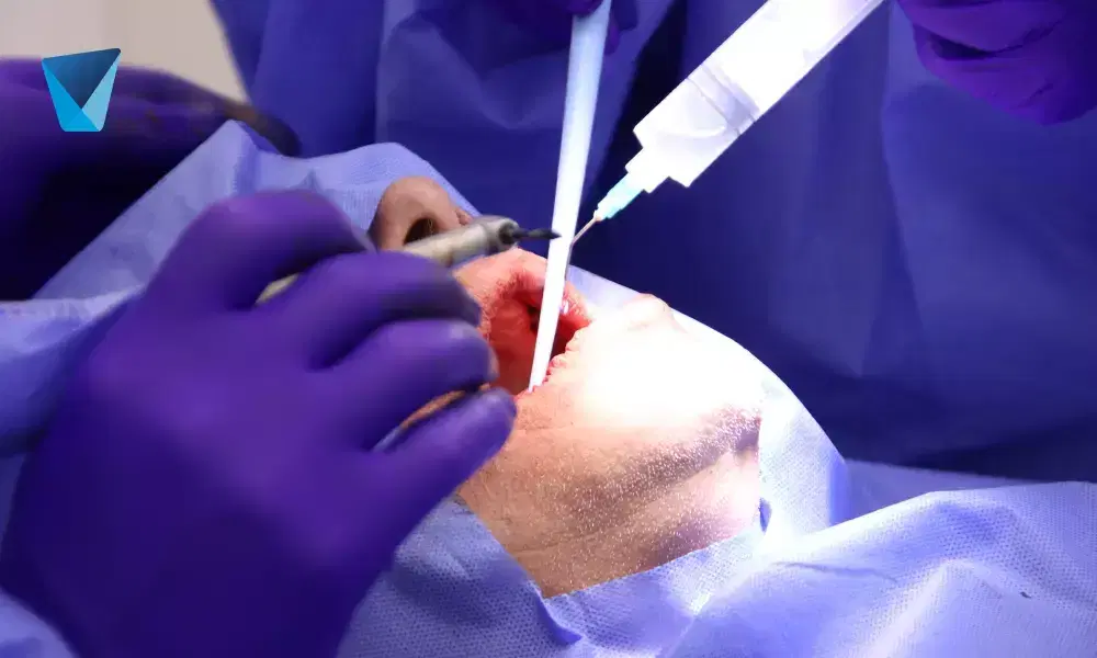 Descubre métodos prácticos y recomendaciones de expertos en Chile para prevenir la acumulación de sarro dental, cuidar tu esmalte y mantener una sonrisa sana y radiante a largo plazo. Consejos Efectivos para Prevenir el Sarro Dental en Chile
