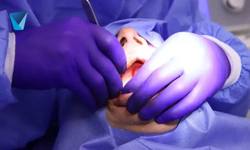 Compara fundas dentales (coronas) y carillas dentales para mejorar tu sonrisa. Descubre cuál es la opción ideal según tus necesidades estéticas y de salud bucal en esta guía completa para chilenos. Fundas y Carillas Dentales: ¿Cuál es la Mejor Opción para tu Sonrisa?