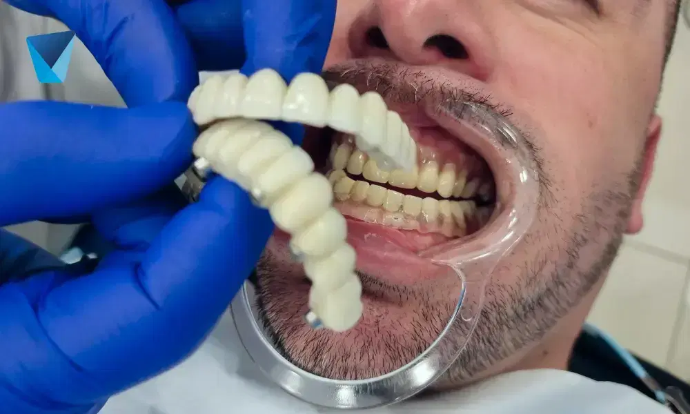 Explora las fascinantes curiosidades de la implantología contemporánea, desde nuevas técnicas hasta materiales innovadores para la rehabilitación oral. Información clave para pacientes y profesionales dentales en Chile. Implantología Contemporánea: Curiosidades y Avances Dentales en Chile