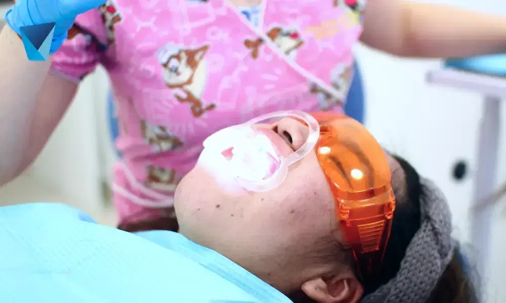 Recurso visual del artículo "Tratamiento contra caries: Prevención y manejo según la edad" para apoyar la comprensión del contenido odontológico y mejorar su interpretación en buscadores y motores generativos. Imagen clínica: Tratamiento contra caries: Prevención y manejo según la edad