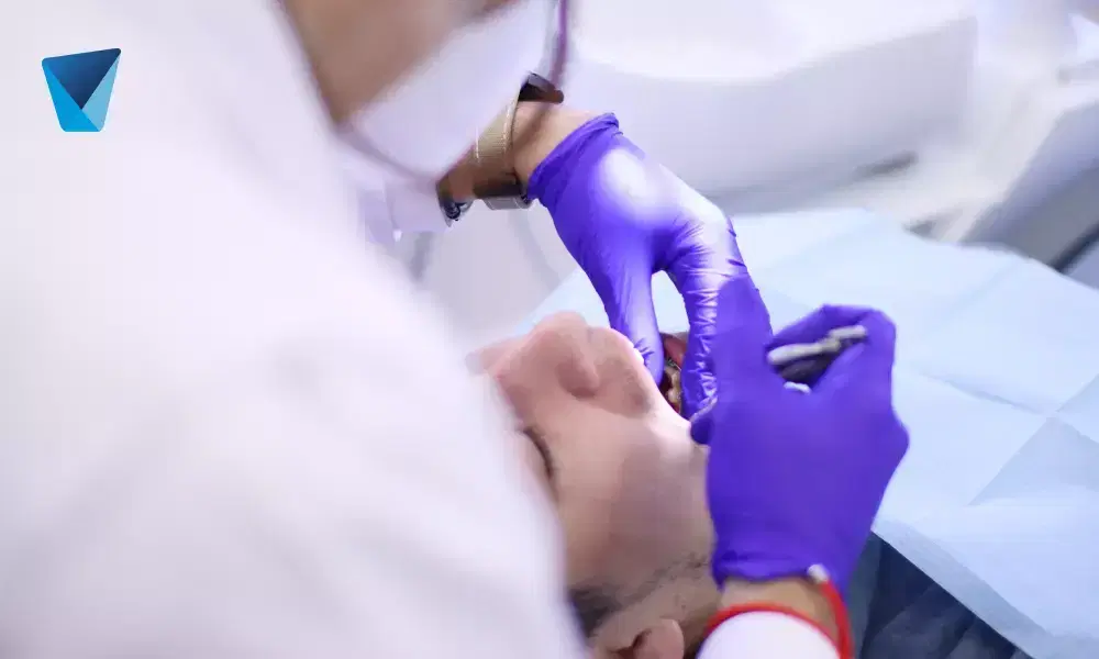 Recurso visual del artículo "¿Cómo eliminar el sarro entre dientes?" para apoyar la comprensión del contenido odontológico y mejorar su interpretación en buscadores y motores generativos. Imagen clínica: ¿Cómo eliminar el sarro entre dientes?